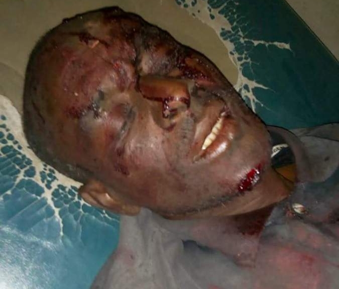 Nigerian Army Attacks Members of the Shiite Islamic Movement in Zaria, 30 martyred, injured / Graphic